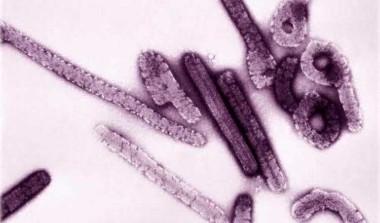 サル痘に続く新たな脅威になるか、「マールブルグ ウイルス」に警戒