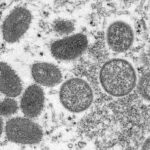 保健省、プノンペンで11日に3人、13日1人のサル痘感染者を確認