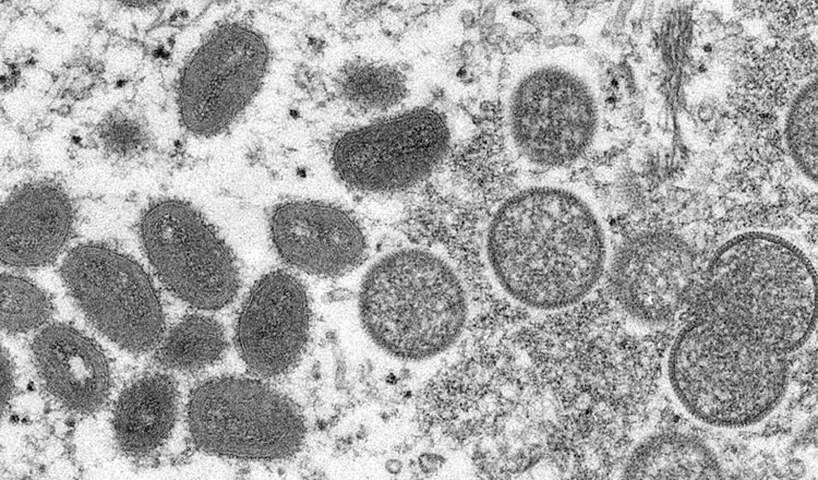 保健省、プノンペンで11日に3人、13日1人のサル痘感染者を確認