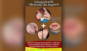 カンボジアで手足口病が増加 昔クンタボッター病院は処置ミスで乳幼児50人前後死亡のミスを犯した