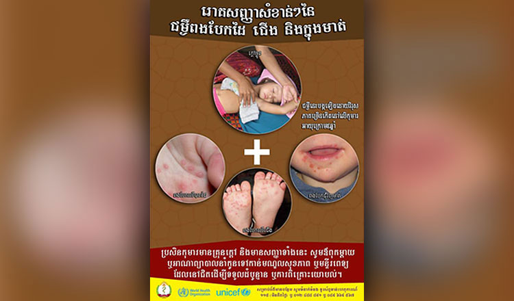 カンボジアで手足口病が増加  昔クンタボッター病院は処置ミスで乳幼児50人前後死亡のミスを犯した