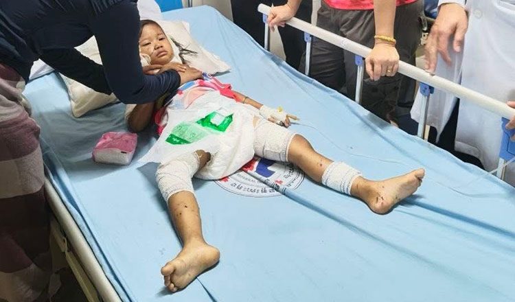 4歳の女の子が犬の群れに襲われて入院