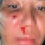 女性がゴム弾で顔を撃たれた事件で警察が捜査中