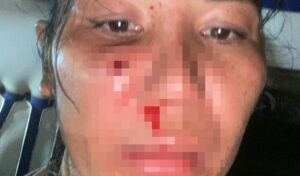 女性がゴム弾で顔を撃たれた事件で警察が捜査中